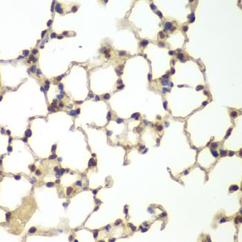 Polyclonal Rabbit anti-Human USF1 / USF Antibody (IHC, IF, WB)