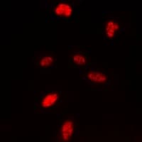 Polyclonal Rabbit anti-Human Histone H3 Antibody (N-Terminus, IHC, IF, WB)