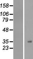 Human H1F0 Protein (Over-Expression Lysate Myc-DDK (Flag))