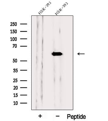PPP3CB Antibody