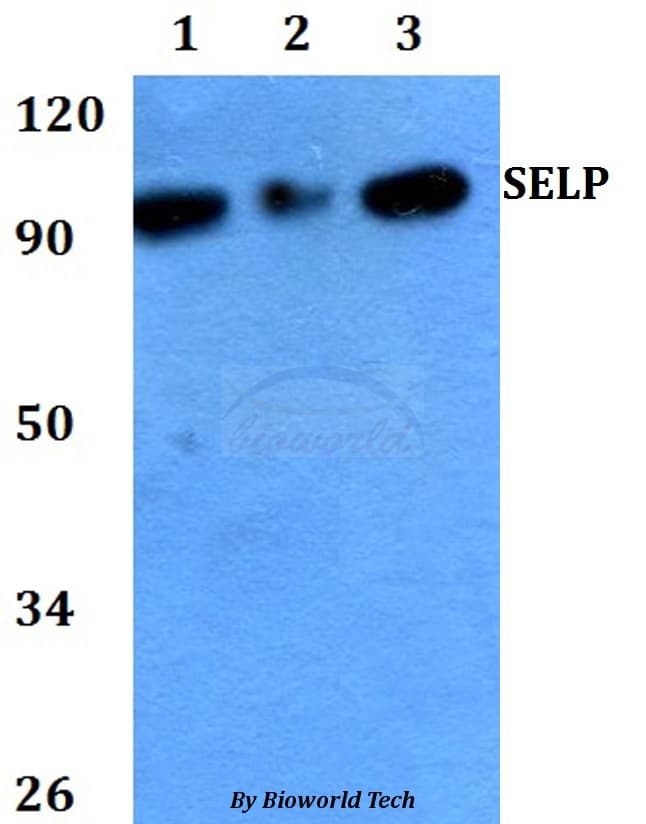 SELP / P-Selectin / CD62P Antibody