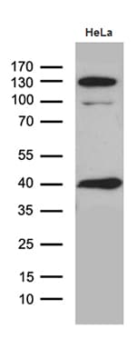Monoclonal Mouse anti-Human GIPC1 / GIPC Antibody (clone OTI5C10, IHC, WB)