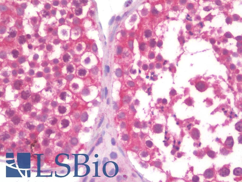 IHC-plus™ VCL / Vinculin Antibody
