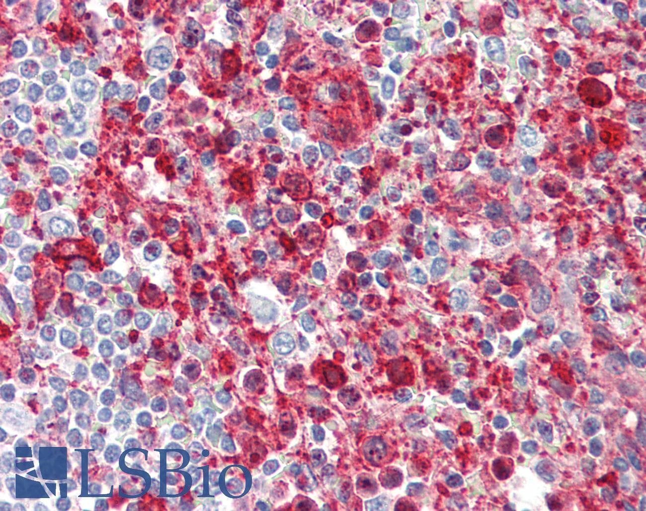 IHC-plus™ GSN / Gelsolin Antibody