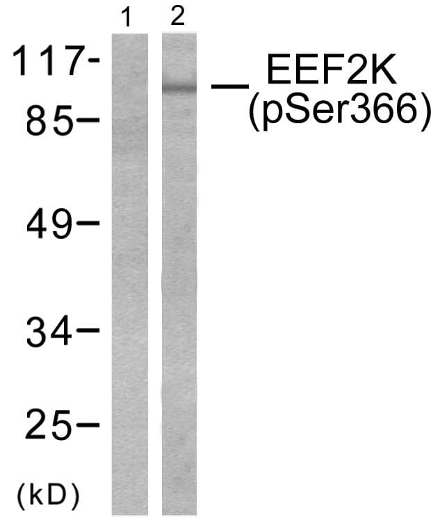 Polyclonal Rabbit anti-Human EEF2K Antibody (phospho-Ser366, WB)