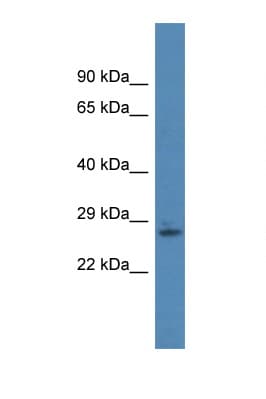 RNF166 Antibody (aa70-119)