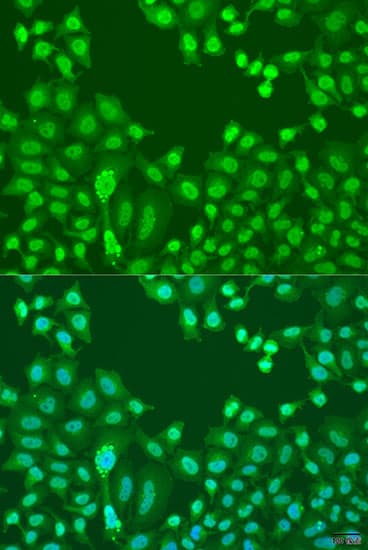 Polyclonal Rabbit anti-Human CTCF Antibody (IHC, IF, WB)