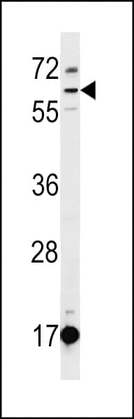 DEPDC1B Antibody (aa462-491)