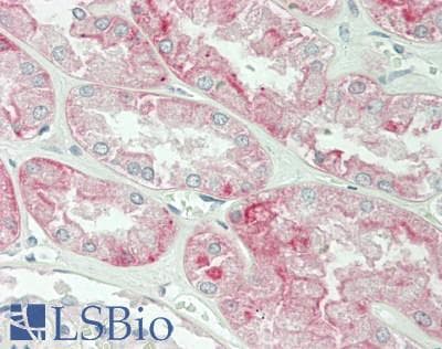IHC-plus™ SLC22A2 Antibody (C-Terminus)