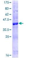 Human PERP Protein (Recombinant GST)