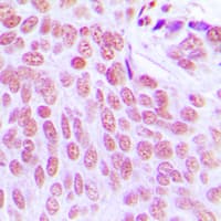 ITPKC Antibody (Internal)