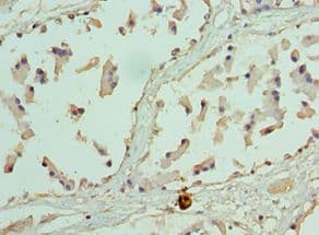 EZH1 / ENX-2 Antibody (aa160-280)
