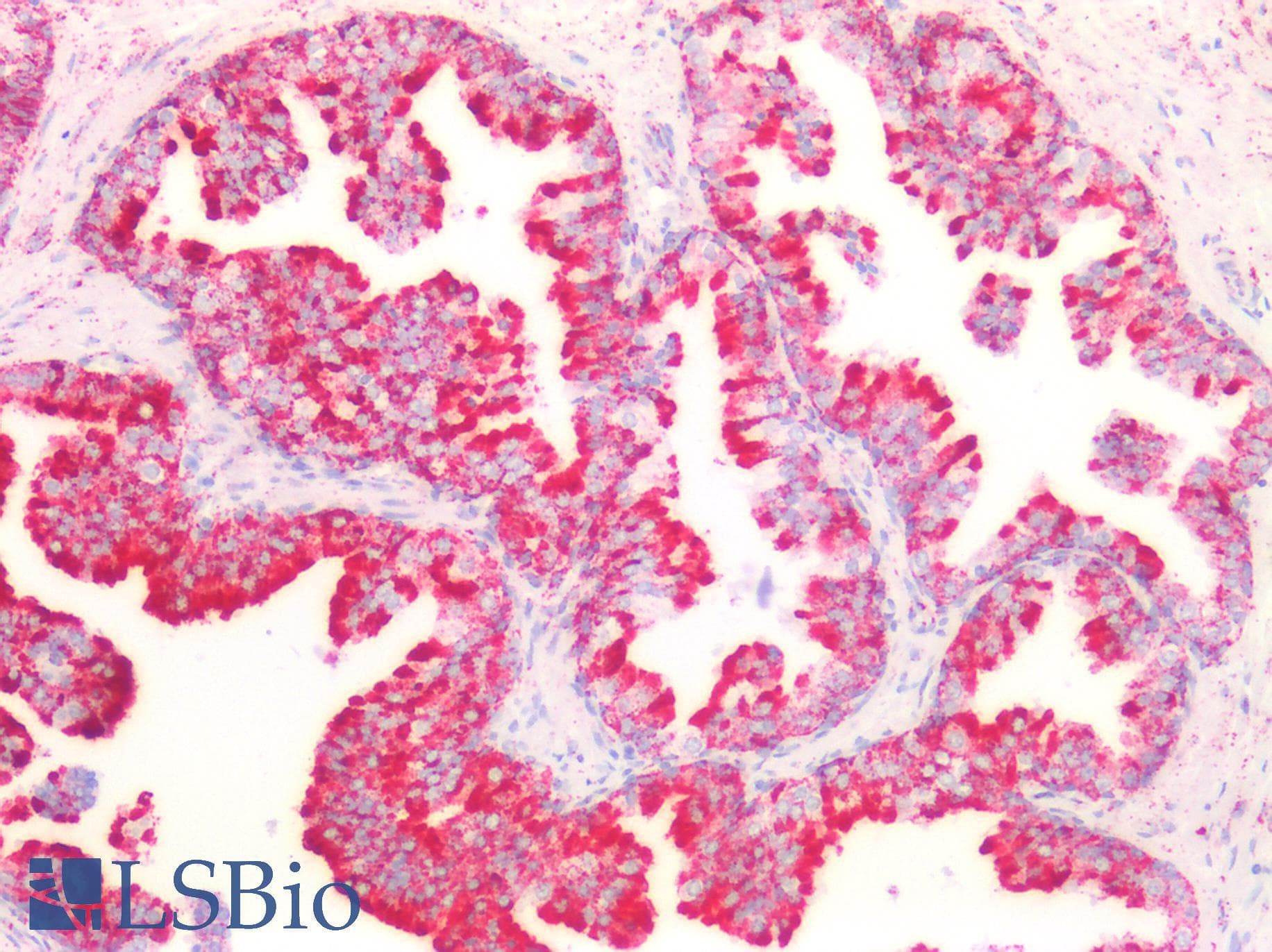 PathPlus™ PVR / CD155 Antibody (aa314-342)
