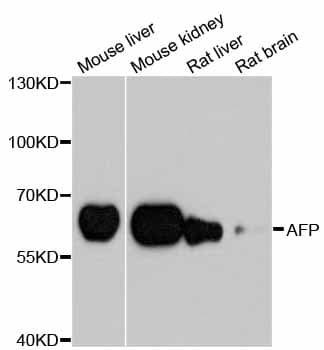 Alpha-Fetoprotein Antibody