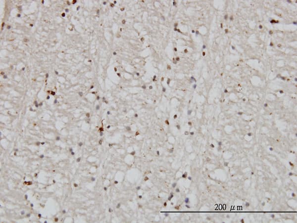 DNAJB2 Antibody (clone 2C9)