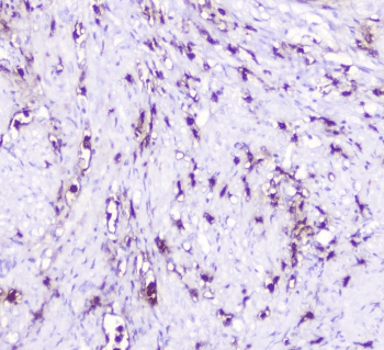 SDF1 / CXCL12 Antibody