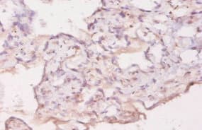 GDF5 / GDF-5 Antibody