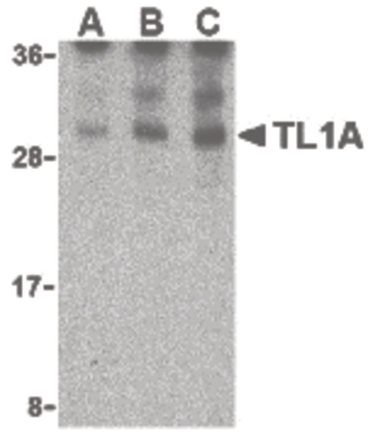 TNFSF15 / TL1A / VEGI Antibody