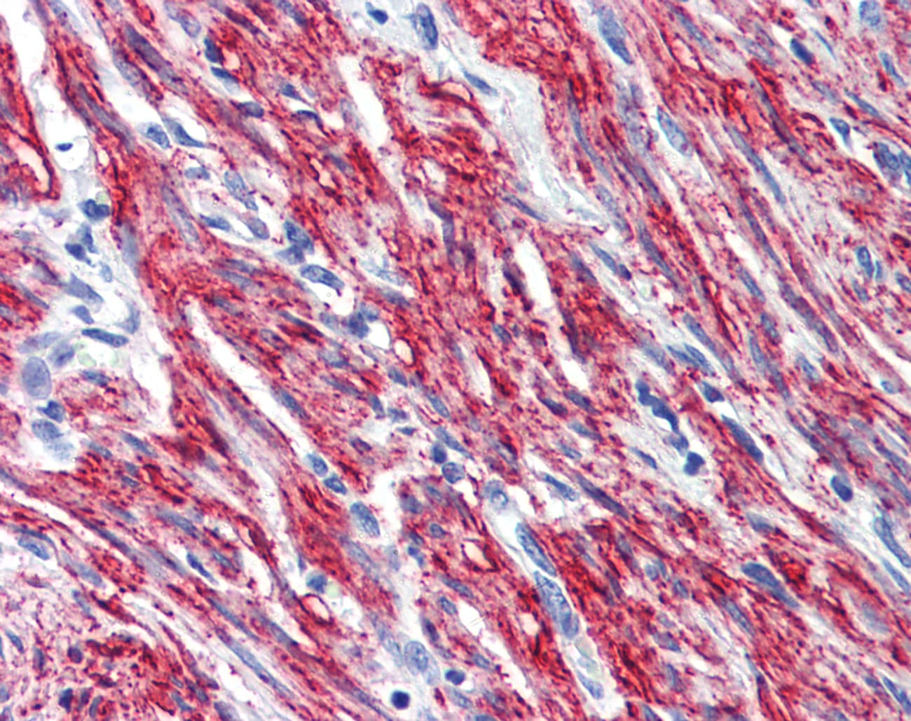 PNPT1 Antibody (aa489-538)