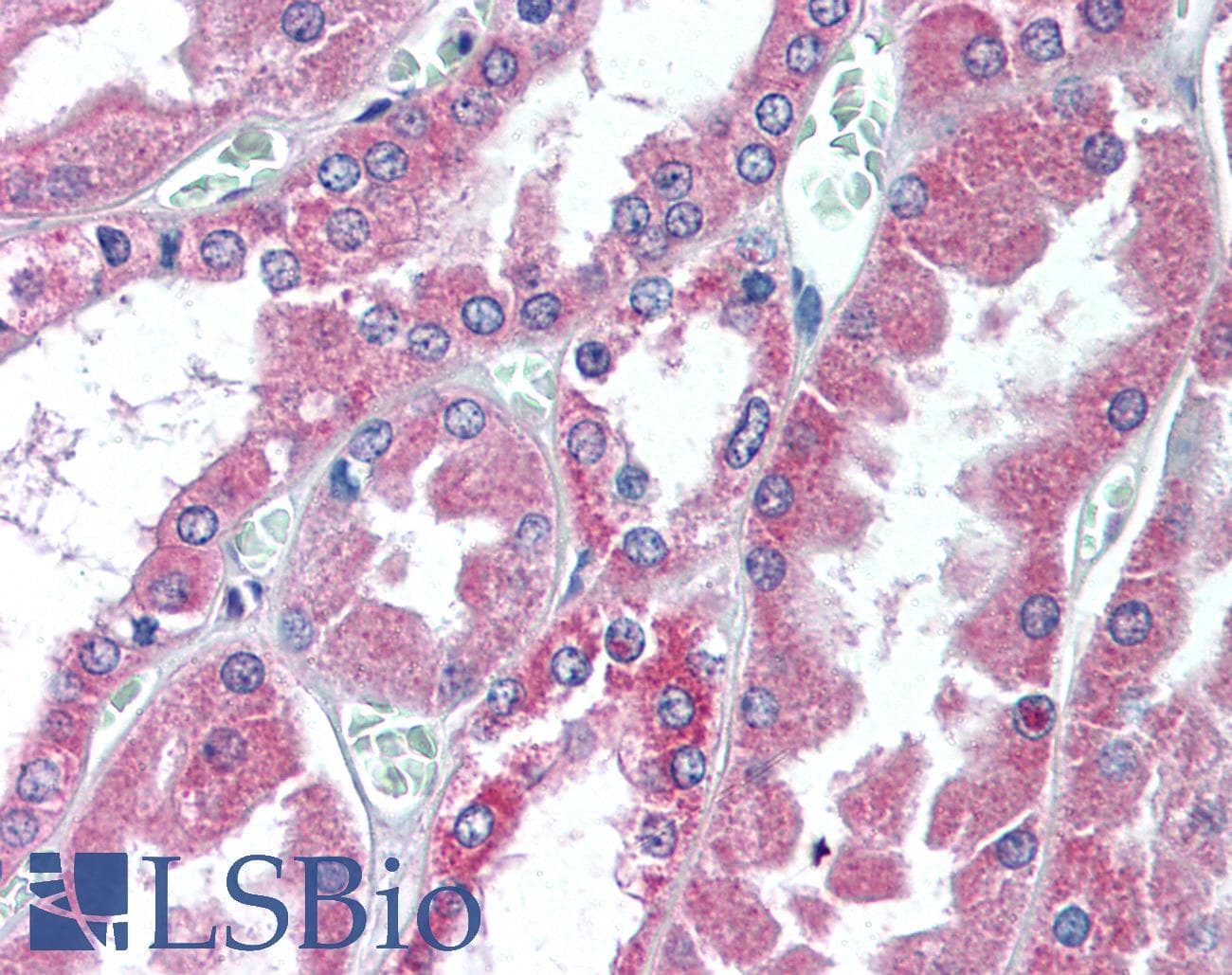 IHC-plus™ Endostatin Antibody (C-Terminus)