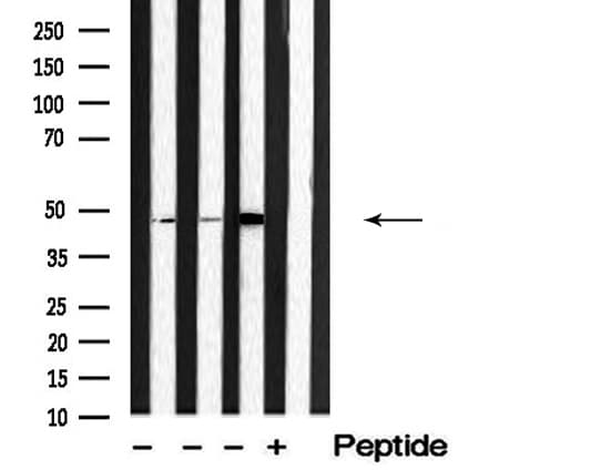 Polyclonal Rabbit anti-Human SEPT7 / Septin 7 Antibody (IF, WB)