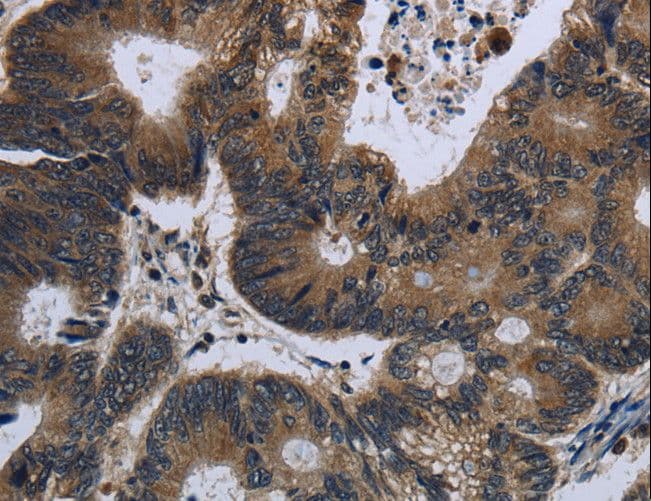 Polyclonal Rabbit anti-Human GALK1 / GK1 Antibody (IHC)