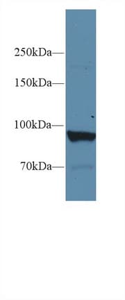 PYGL Antibody (aa633-820, Biotin)