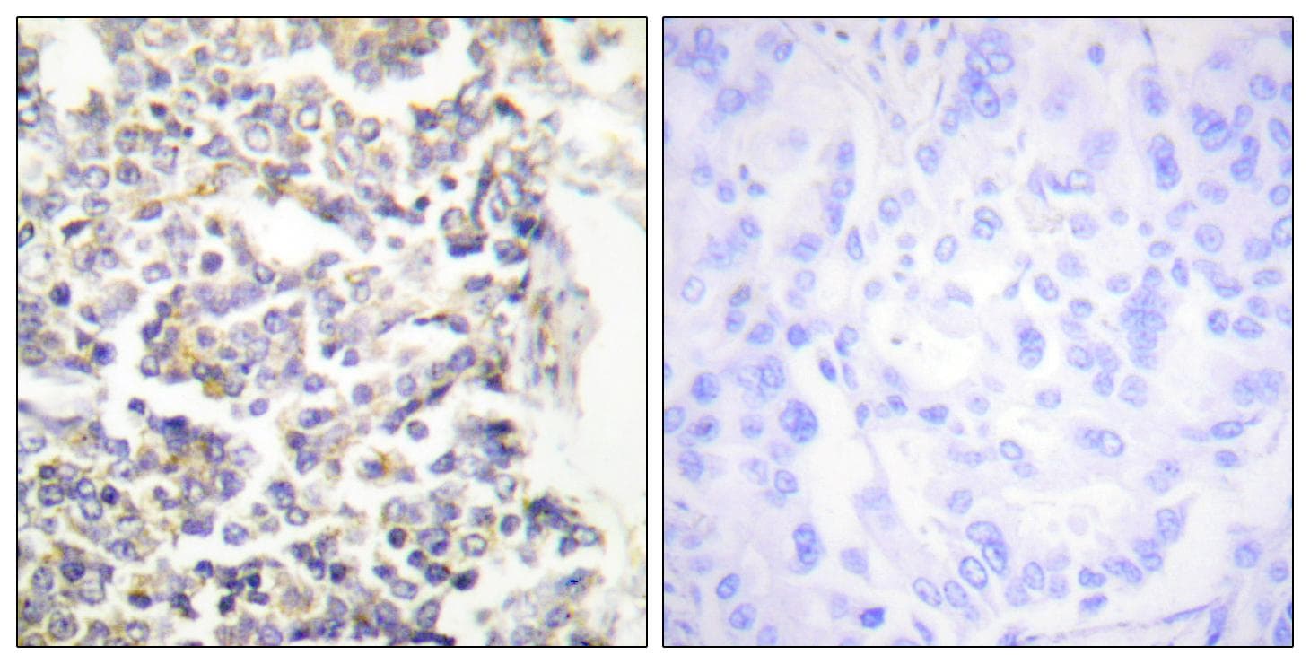 C-TAK1 / MARK3 Antibody