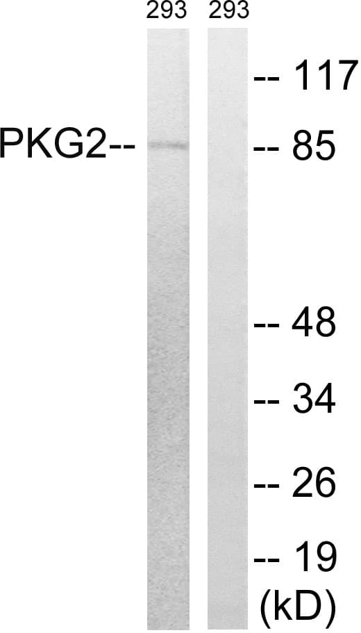 PRKG2 / CGKII Antibody (aa92-141)