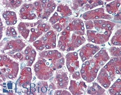 IHC-plus™ CPB / Carboxypeptidase B Antibody