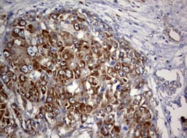 PIK3C2A Antibody (aa230-560, clone OTI2E4)