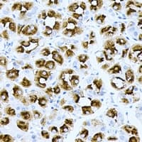 HRAS / H-Ras Antibody