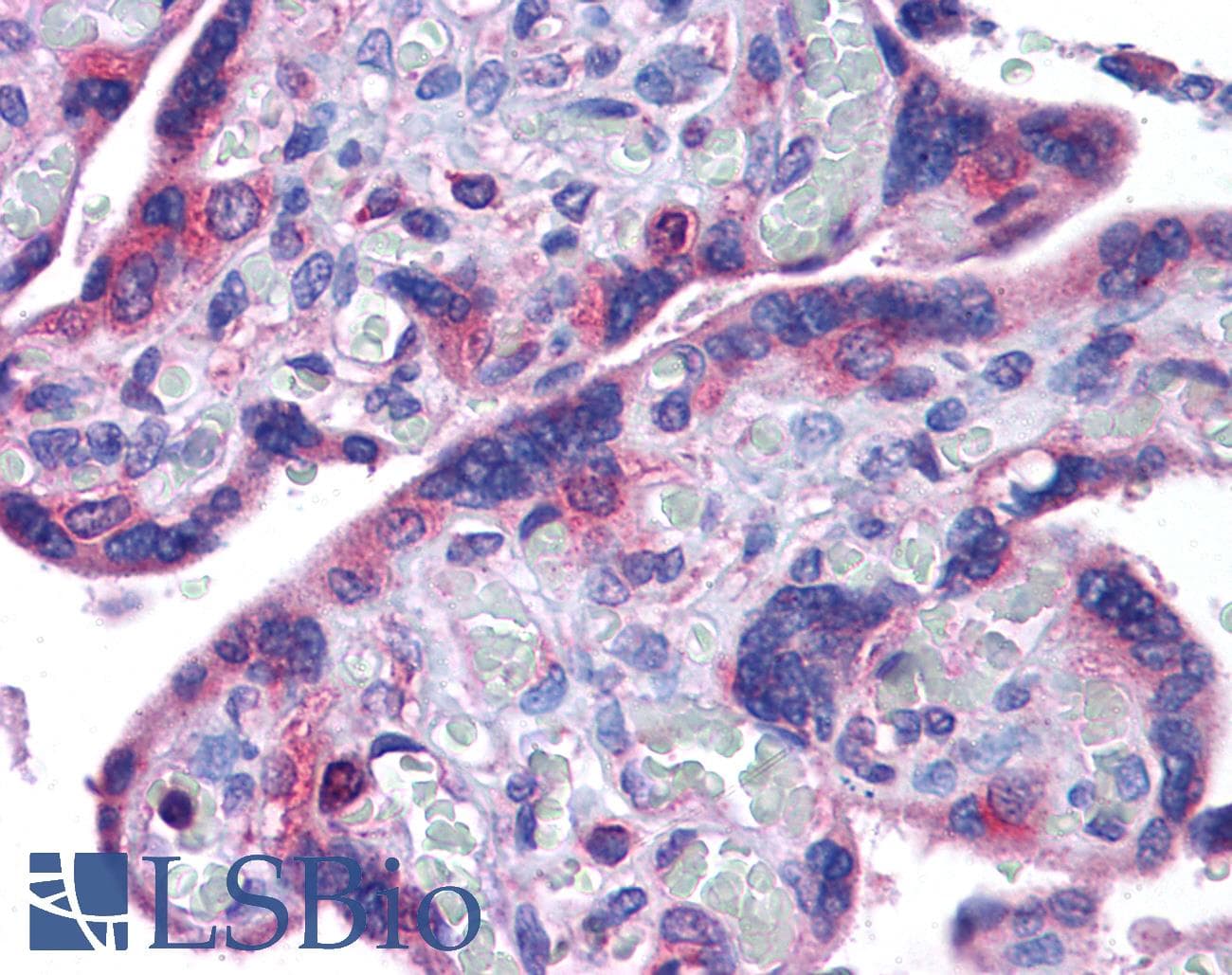 IHC-plus™ Polyclonal Rabbit anti-Human NOD8 / NLRP10 Antibody (IHC, IF, WB)