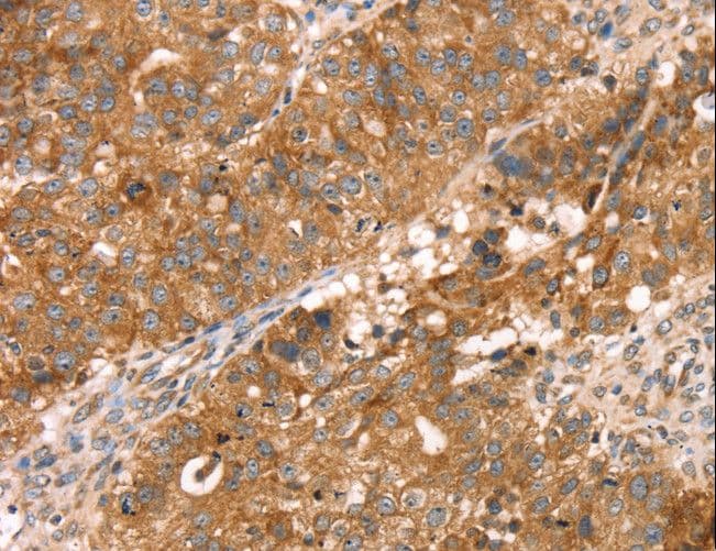 PDLIM4 / RIL Antibody