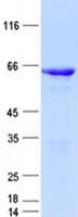 Human DLX5 Protein (Recombinant GST, N-terminus + His, C-terminus)