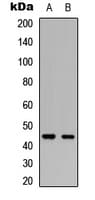 PDK2 Antibody (Internal)