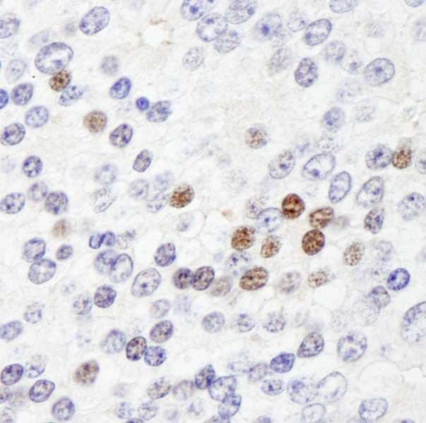Polyclonal Rabbit anti-Human ZHX3 Antibody (aa150-200, IHC, IF)