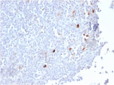 IGHM / IgM Antibody (clone IGHM/2559R)