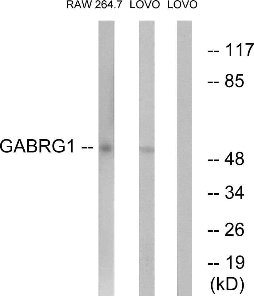 Polyclonal Rabbit anti-Human GABRG1 Antibody (aa11-60, WB)