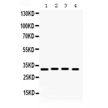 Polyclonal Rabbit anti-Human KCNIP2 / KCHIP2 Antibody (aa78-112, IHC, WB)