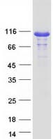 Human HRS / HGS Protein (Recombinant Myc-DDK (Flag))