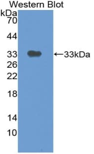 TP / Thymidine Phosphorylase Antibody (aa29-305, Biotin)
