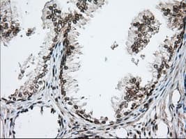 ERIC-1 / TACC3 Antibody (clone OTI1E8)