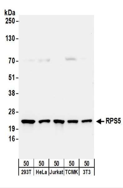 RPS5 / Ribosomal Protein S5 Antibody (aa1-50)