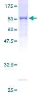 Human TKFC / DAK Protein (Recombinant GST)