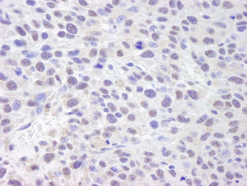 Polyclonal Rabbit anti-Human ASH2L / ASH2 Antibody (aa575-C-term, IHC)