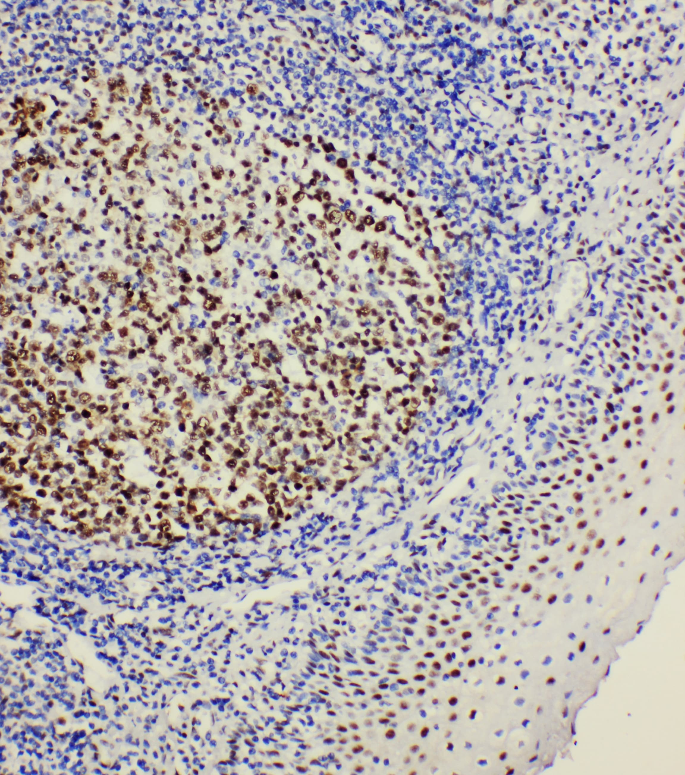 Polyclonal Rabbit anti-Mouse POU2AF1 / BOB1 Antibody (aa238-256, IHC, WB)