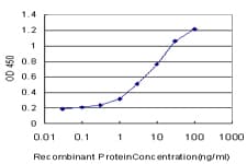 IHC-plus™ SGK1 / SGK Antibody (clone 3E3)