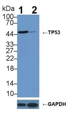 TP53 / p53 Antibody (aa108-370)