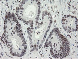 TLE1 / TLE 1 Antibody (clone OTI1D6)